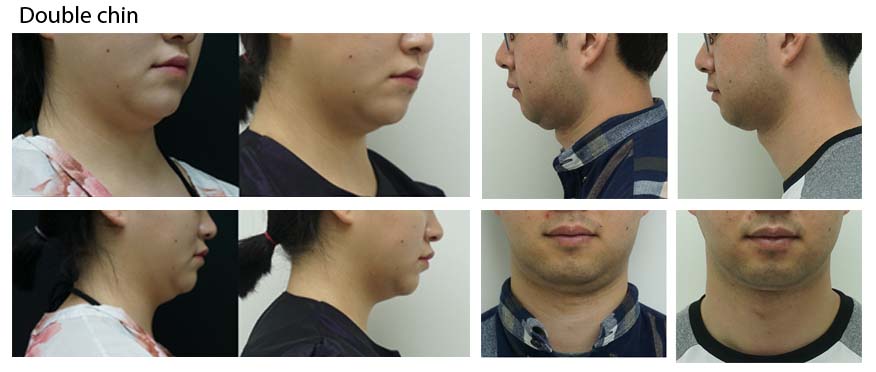 Clatuu-before after.jpg