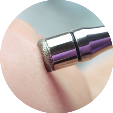 diamond-microdermabrasion