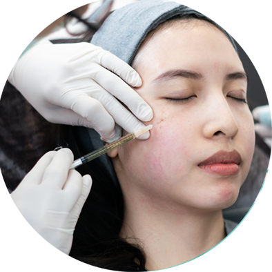 cara menghilangkan kantung mata