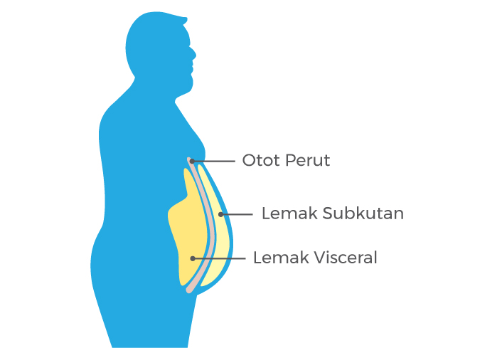 cara menghilangkan lemak di perut