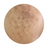flek melasma