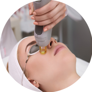 menghilangkan-hemangioma-pulsed-dye-laser