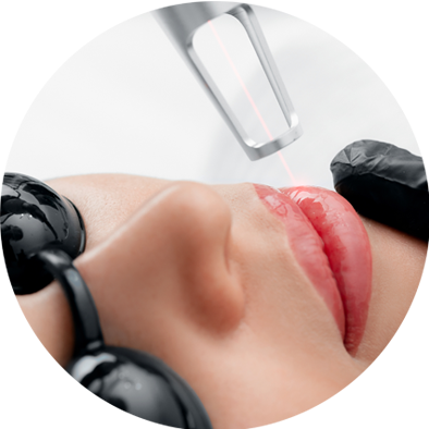 prosedur-laser-lip-rejuvenation.png