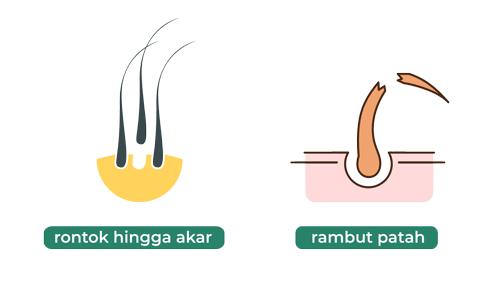 rambut rontok dan rambut patah