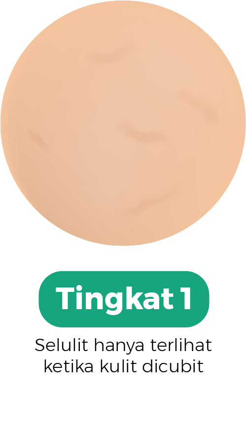 selulit tingkat 1