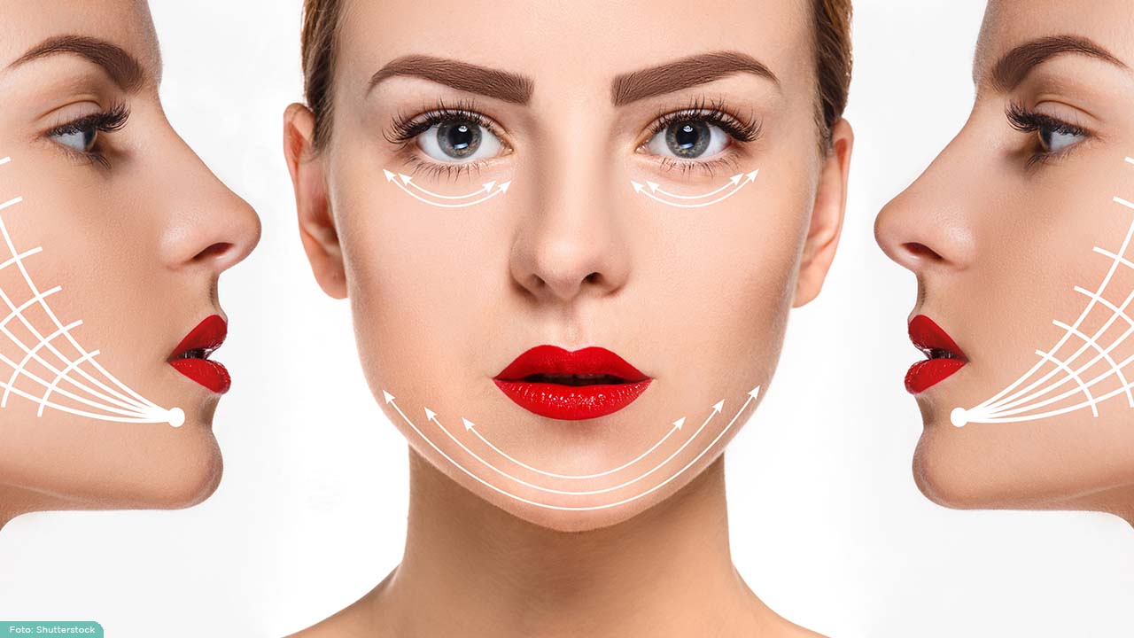 teknik-tanam-benang-tarik-benang-heystetik